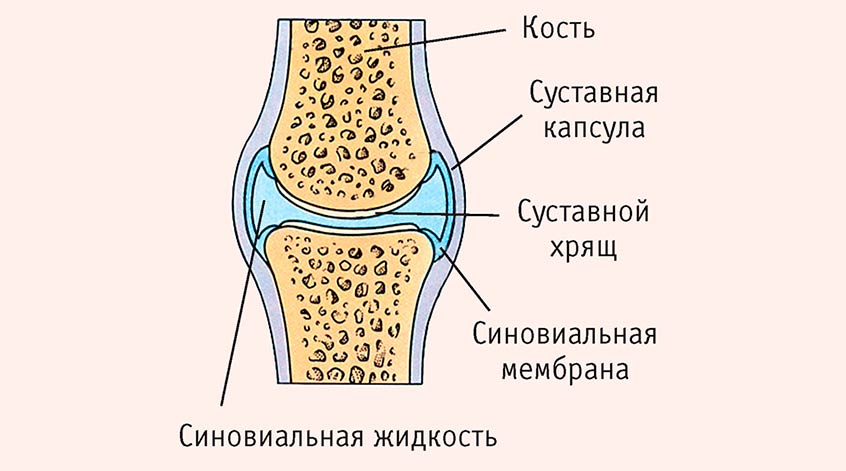 Жидкость в коленном суставе (выпот) — Лечение в Казани