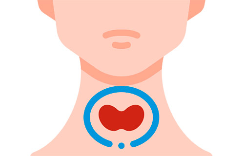 Другие заболевания щитовидной железы – одна из причин гипотиреоза