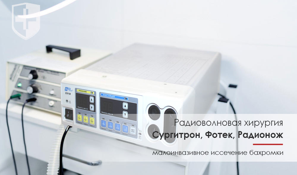 Радиоволновое лечение бахромок прямой кишки в Казани